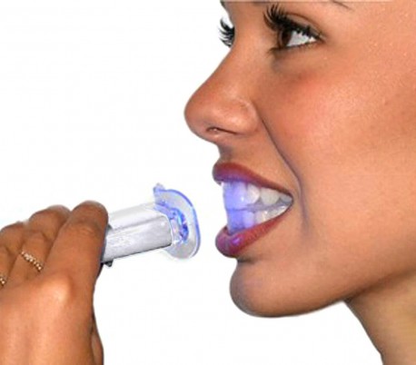 870325 Kit de tratamiento para blanquear los dientes en 20 minutos SMILE WHITE