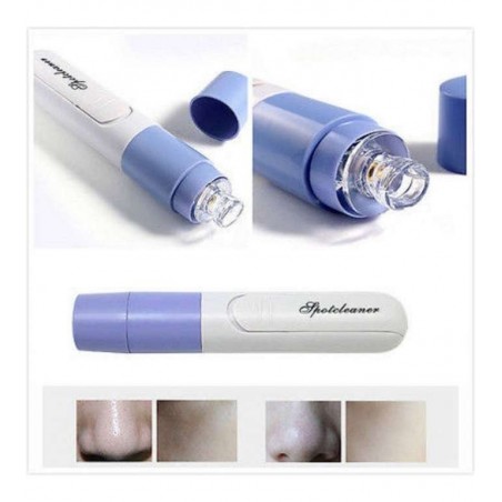 178521 Limpiador facial para limpiar la piel de baterías y los poros.