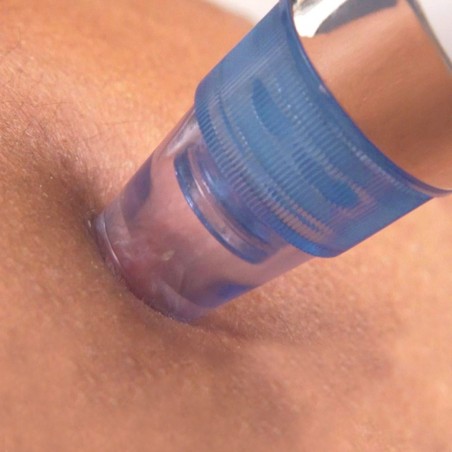 345636 Limpiador facial aspirador SUCTION limpieza poros espinillas e impurezas