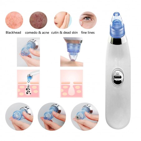 345636 Limpiador facial aspirador SUCTION limpieza poros espinillas e impurezas