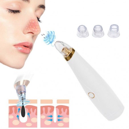 415007 Aspirador para eliminar puntos negros y espinillas para limpieza Facial