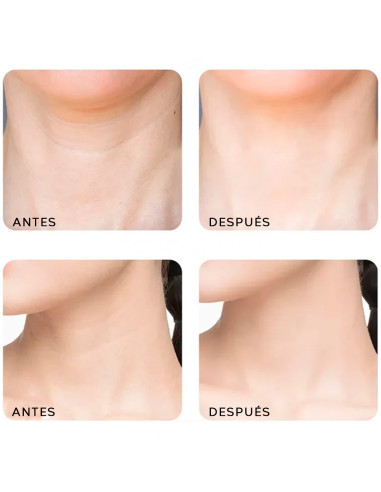 Masajeador belleza recargable masaje cuello...